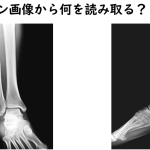 リハビリテーション科で足関節について勉強会をしました。