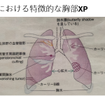 リハビリテーション科で循環器疾患の勉強会をしました。