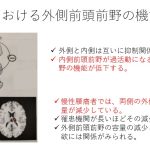 リハビリテーション科で痛みと脳の関係について勉強しました
